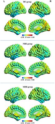 Altered dynamic spontaneous neural activity in minimal hepatic encephalopathy